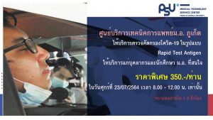 เปิดให้บริการตรวจคัดกรองโควิด-19 ในรูปแบบ Rapid Test Antigen แก่บุคลากรและนักศึกษา ม.อ. ที่สนใจในราคาพิเศษ